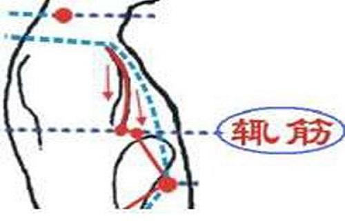 辄筋痛怎么治疗 辄筋的准确位置图片