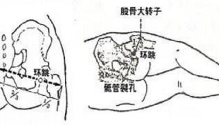 环跳的准确位置图视频 环跳最简单易懂找法