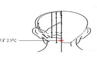 手哑门的准确位置图片 哑门的功效和作用