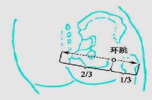 环跳的简便定位