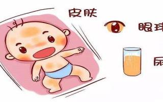 母乳性黄疸降了又升怎么办 母乳性黄疸该如何退黄