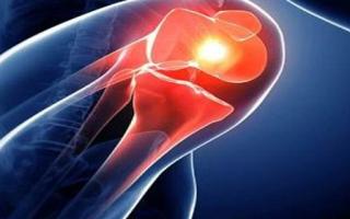 膝关节滑膜炎是什么原因引起的 膝关节滑膜炎挂哪个科室