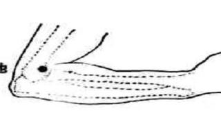 曲池针刺方法 针刺曲池的好处