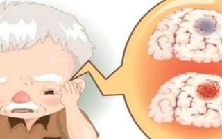 脑血管意外是怎么回事 脑血管意外有哪些疾病