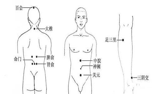 艾灸前列腺炎