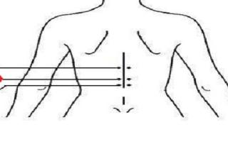 三焦俞的准确位置图 三焦俞的定位与主治