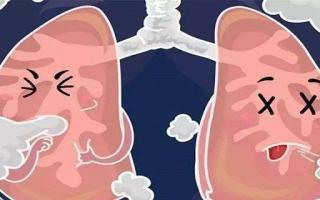 肺癌的早期信号有哪些 肺癌会引起咳嗽吗